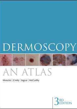 Dermoscopy: an atlas 3e
