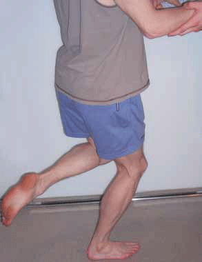 Figure 3. Thessaly test: The clinician holds the 
patient's outstretched hands for support, while the 
patient stands flat-footed with their knee flexed to 
20 degrees and rotates their body and knee three 
times, internally and externally. The test is positive if 
symptoms are reproduced on rotation
10