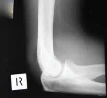 Case 4 x-ray image