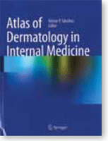 Atlas of dermatology in internal medicine