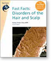Fast Facts: Disorders of the Hair and Scalp