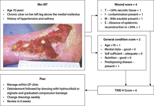 Leg Ulcer Assessment Chart