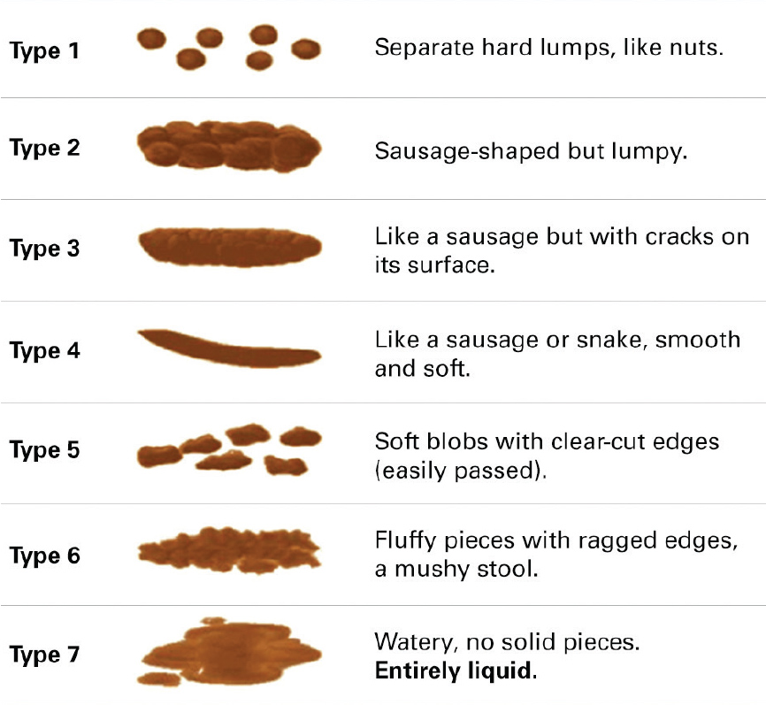 Paediatric Bristol Stool Chart