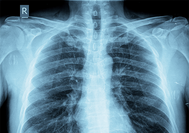 Respiratory Medicine: A Comprehensive Update on Interstitial Lung Disease and Legionella and Leptospirosis.