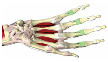 Figure 5. Hand with volar plates at PIP highlighted.