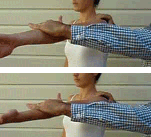 Figure 5. The Active compression (O'Brien) test for ACJ 
pathology. Testing in internal and external rotation. The 
clinician stands behind or to the affected side of the 
patient. The affected arm is flexed to 90 degrees with the 
elbow fully extended, the arm is then adducted about 15 
degrees medial to the sagittal plane. The arm is internally 
rotated so that the thumb points to the floor, the patient 
then resists the downward force applied by the clinician. 
Maintaining the arm in the same position, the patient then 
supinates the arm so as the palm is facing upward and 
resisting another downward force. The test is positive and 
diagnostic of ACJ pathology if pain is elicited over the 
ACJ or on top of the shoulder in the thumb down position 
and reduced or eliminated in the palm up position