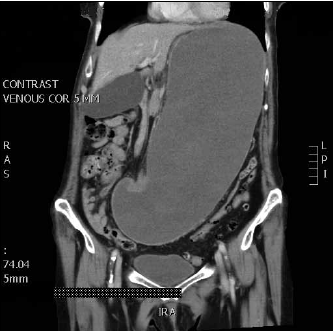 Figure 2. CT scan of the patient's
abdomen