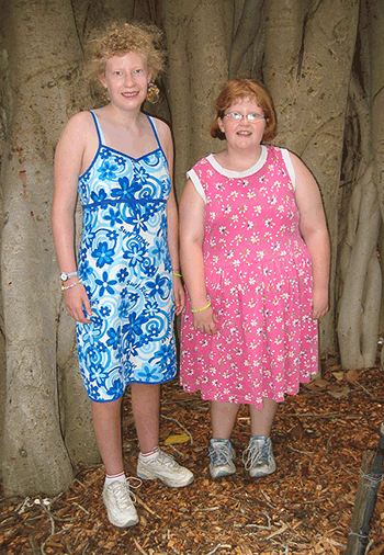 Figure 1. Two adolescent girls with
Prader-Willi syndrome. One (left)
received growth hormone treatment for
4 years; the other (right) received no
growth hormone treatment