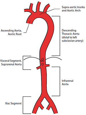 Figure 1. Anatomical reference terms for aortic segments