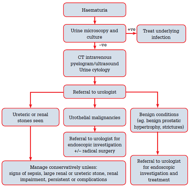 Figure 1. An approach to the investigation and initial management of macroscopic haematuria