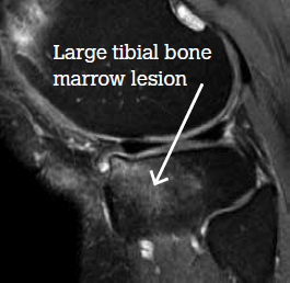 Figure 1. MRI scan at baseline