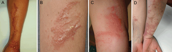 Figure 1. Clinical appearance of the patients