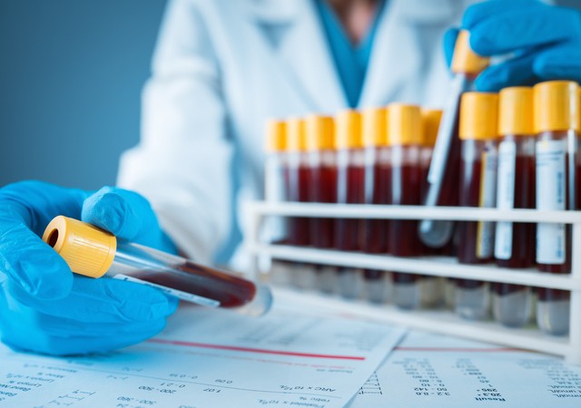 Biomarkers and monoclonal antibodies