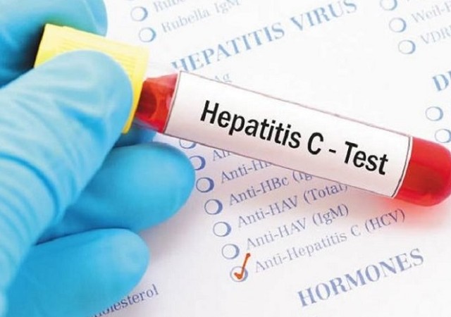 Hepatitis C treatment and the role of the GP